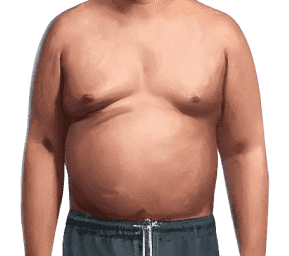 man with fat torso